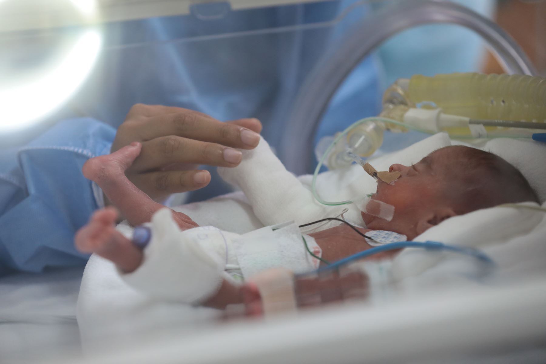 Día Mundial Del Niño Prematuro Cada Año Nacen 30 Mil Bebés Prematuros En El País Federación 9140